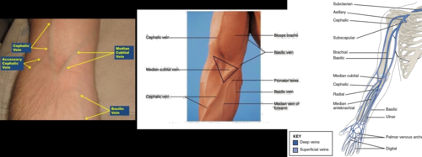 <p>2-6 inches above site, tightly cross &amp; tuck a loop in from the top (but don’t pull the end through) so that you can pull the short end away from injection site</p>