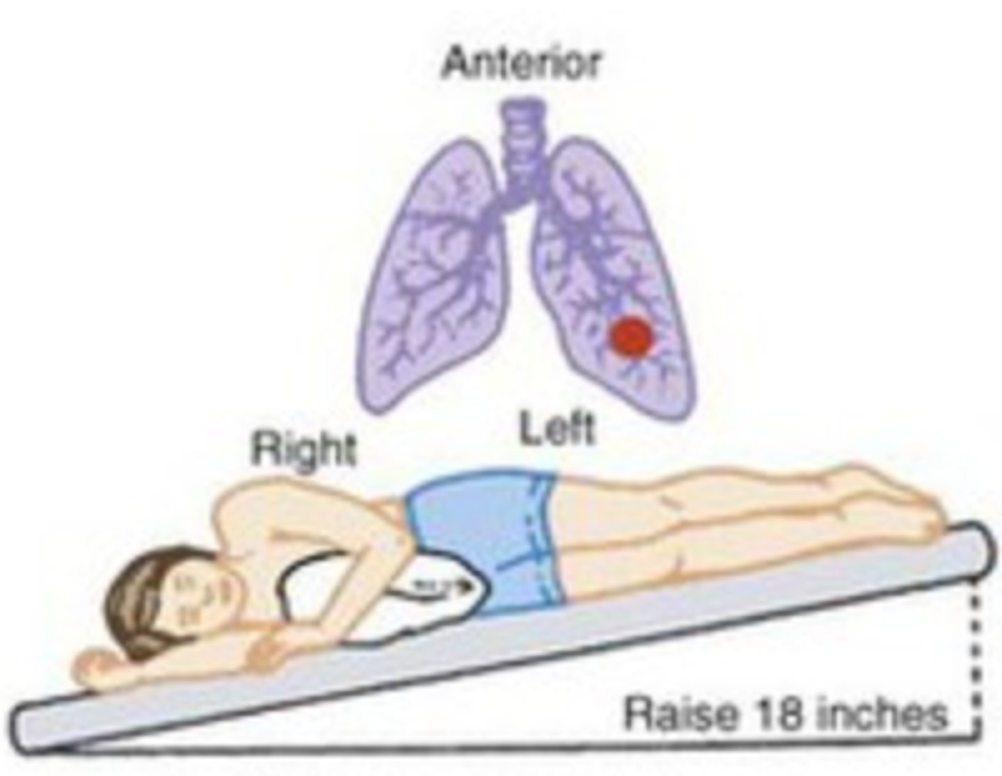 <p>- Position the patient on the right side with the foot of the bed elevated 18 - 20 inches.</p><p>- Area to percuss is over the lower ribs.</p>