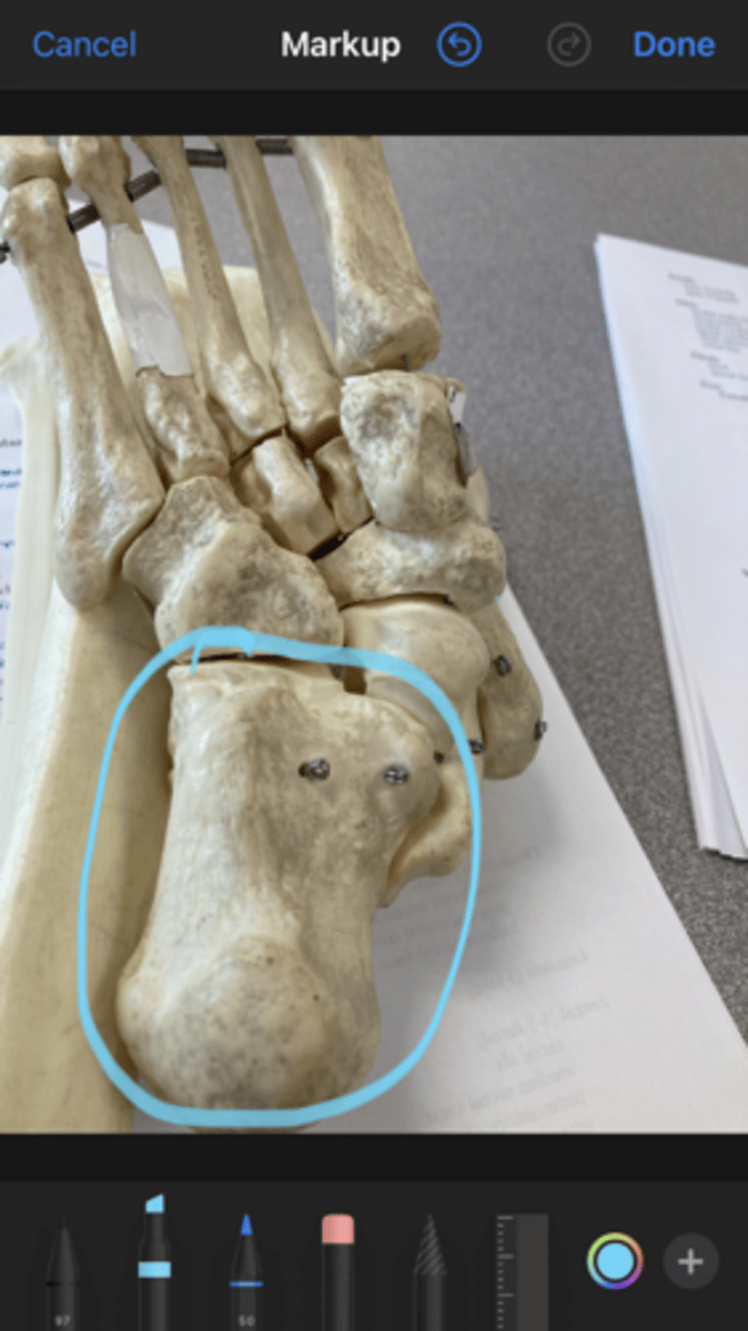 <p>inferior view</p>