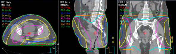 <ul><li><p>CBCT image</p></li></ul><p></p>