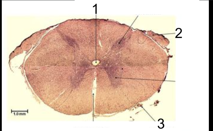 <p>what structure is #2?</p>