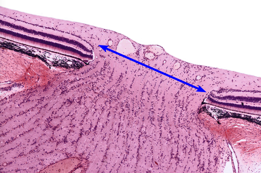 inner layer 