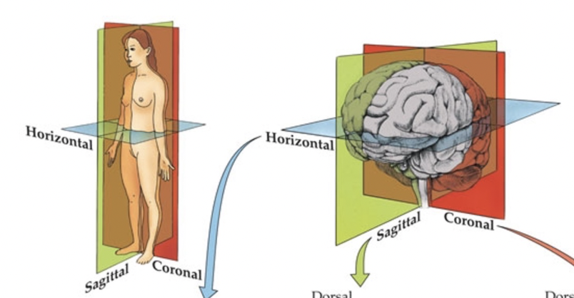 <p>Saggital, Coronal, and Horizontal</p>