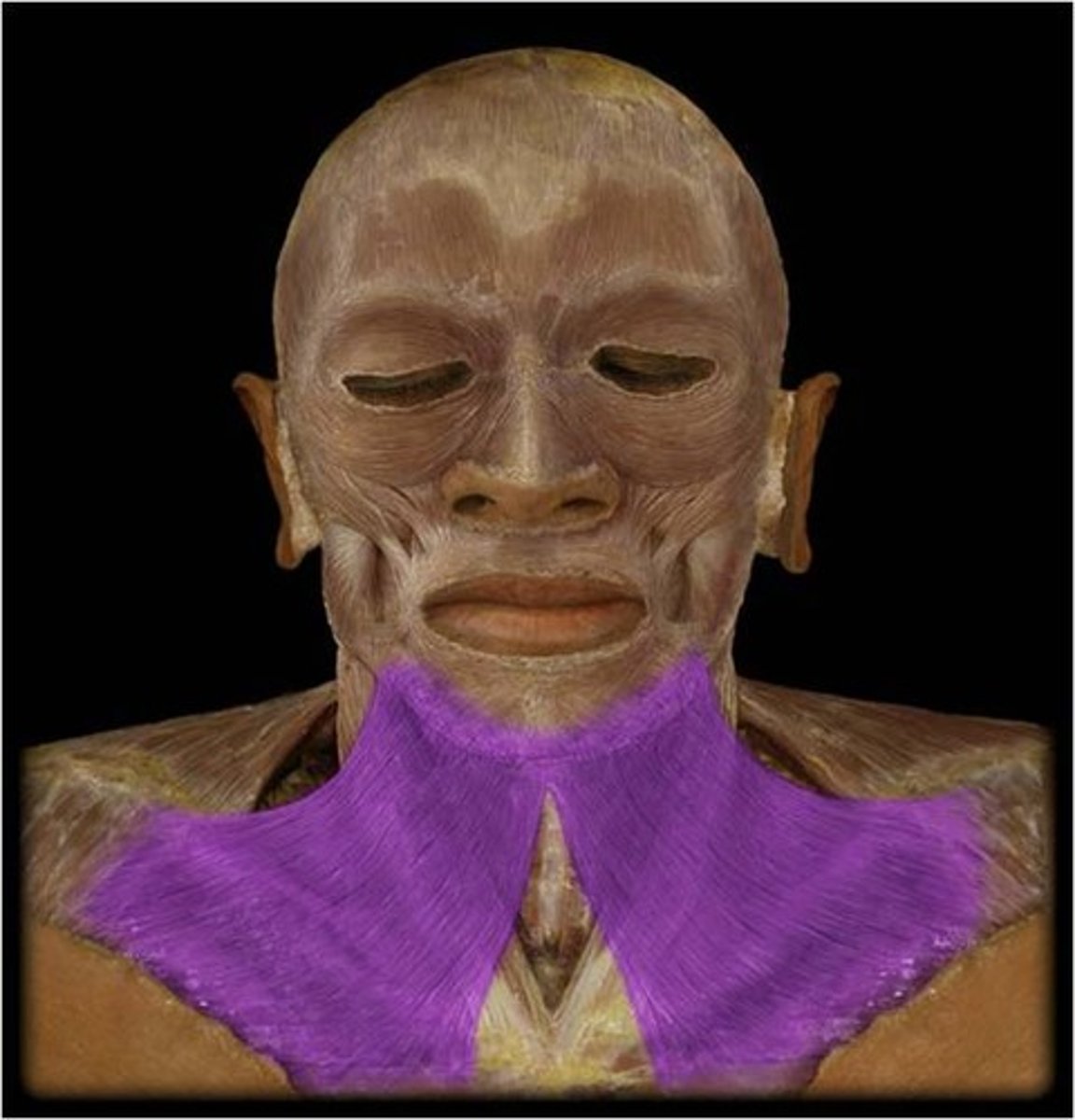 <p>Draws down the lower lip and angles of the mouth; tenses skin of the neck; helps depress mandible</p>