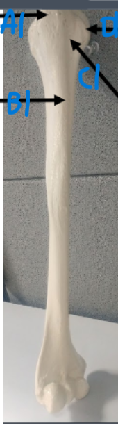<p>What is C1? on the humerus</p>