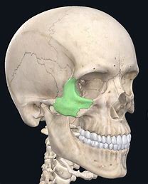<p>What facial bone is this?</p>