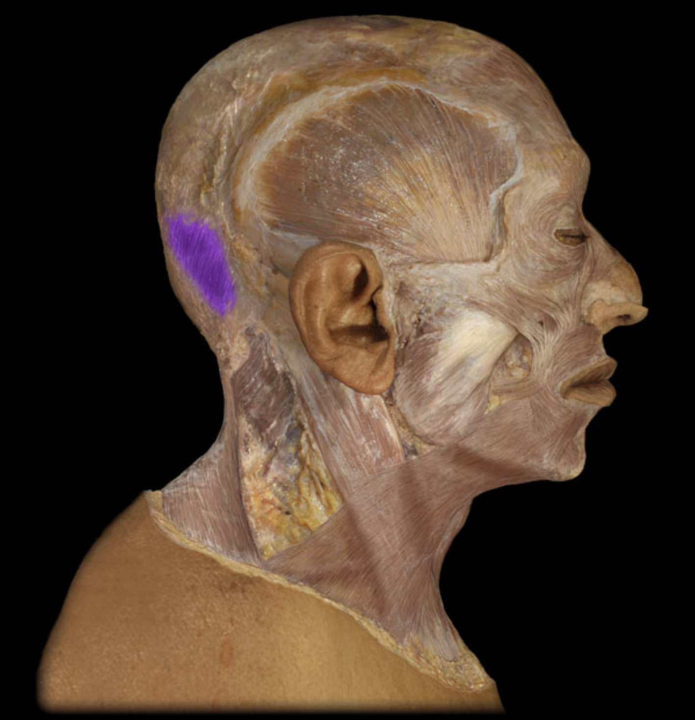 <p>What is/are this muscle’s origin(s)?</p>