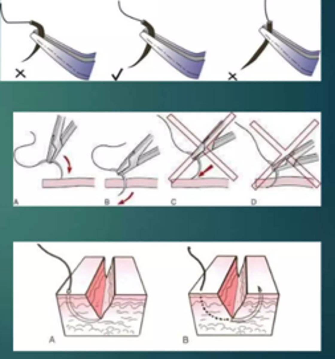 <p>•Needle should be grasped at approximately 1/3 of the distance from the eye &amp; 2/3 from the point</p><p>•Needle should pierce the tissue perpendicular to its surface</p><p>•Needle should be placed equidistant (2-3mm) from the incision line</p>