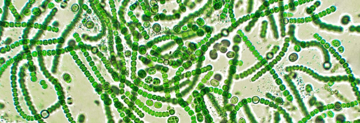 <p>Cyanobacteria (Blue Algae)</p>