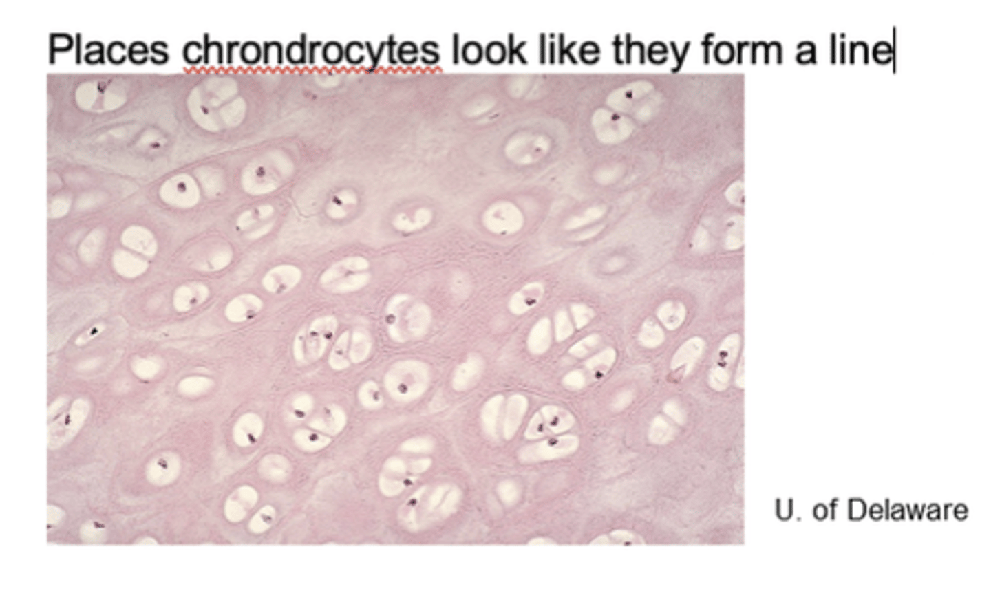 <p>Fibers</p><p>- Collagen fibers thicker than in hyaline cartilage</p><p>Function</p><p>- Strength, resists compression, absorbs shock</p><p>Location</p><p>- Intervertebral disease, pubic symphysis, knee joint</p><p>- Important for childbirth</p>