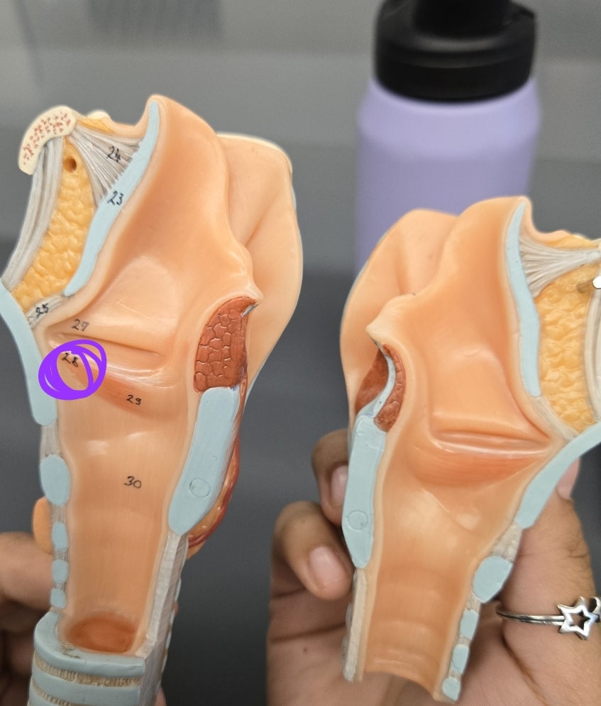 <p>Larynx, Trachea, and Bronchi model: What structure is this?</p>