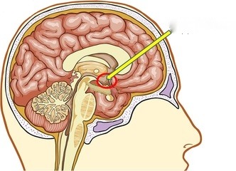Part of the limbic system; controls mood, hunger, thirst, and temperature; also contains glands that control the hormonal processes throughout the body; helps govern the endocrine system via the pituitary gland