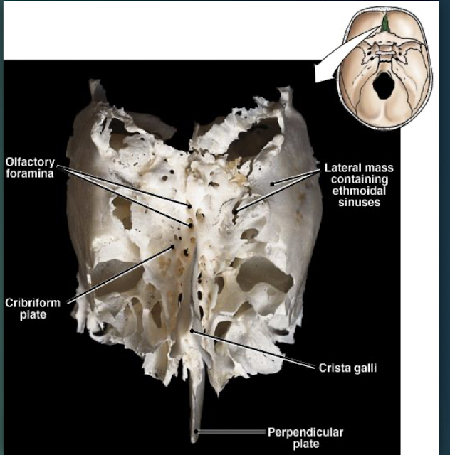 <p>Deepest skull bone; forms superior nasal septum and medial orbit walls; cribriform plate with olfactory foramina and crista galli.</p>