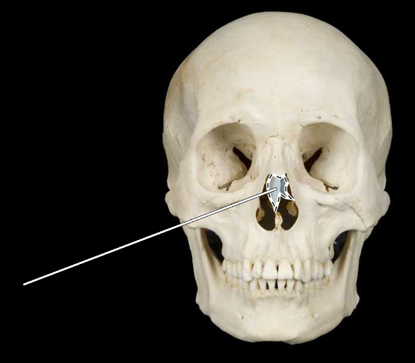 <p>Name this bone.</p>