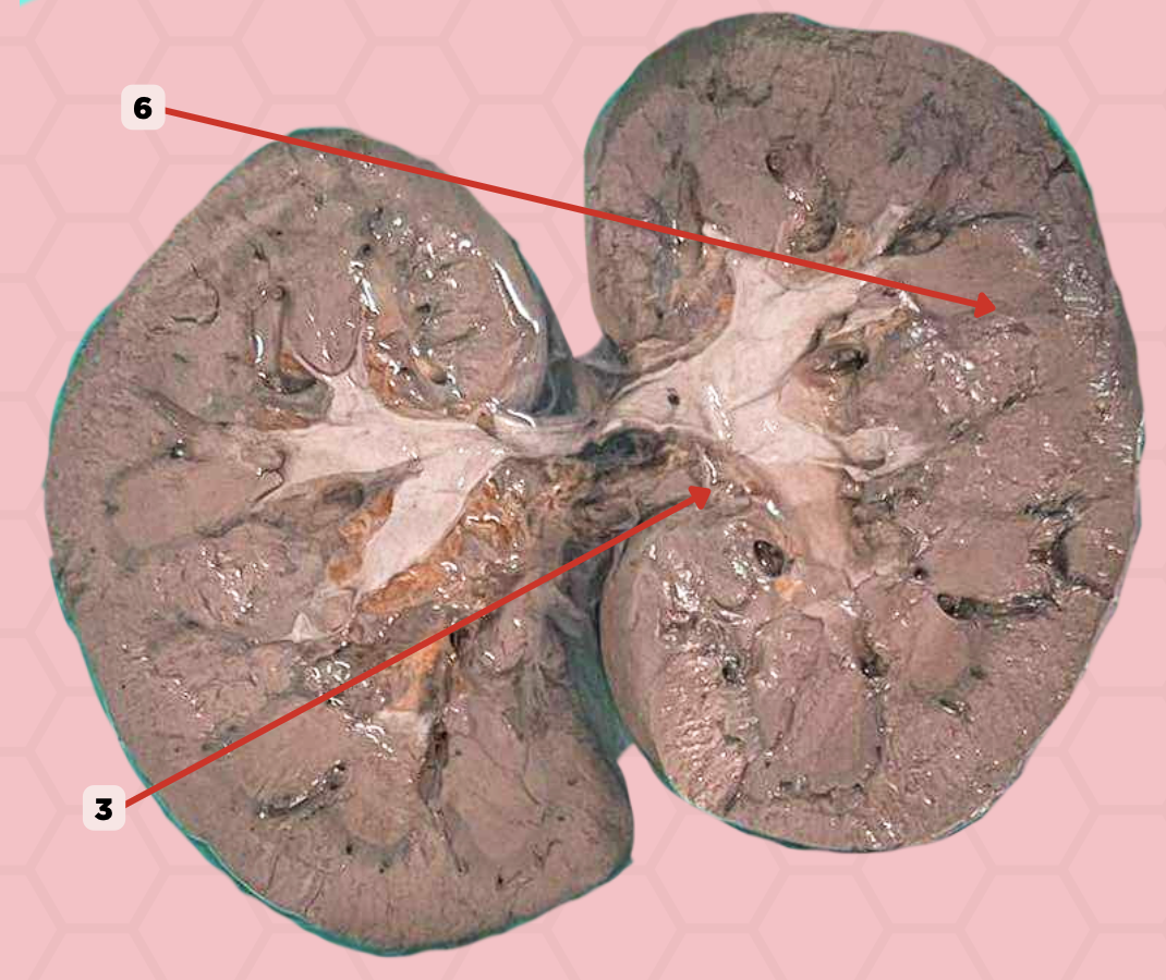<p>Identify the structure labeled as 6.</p>