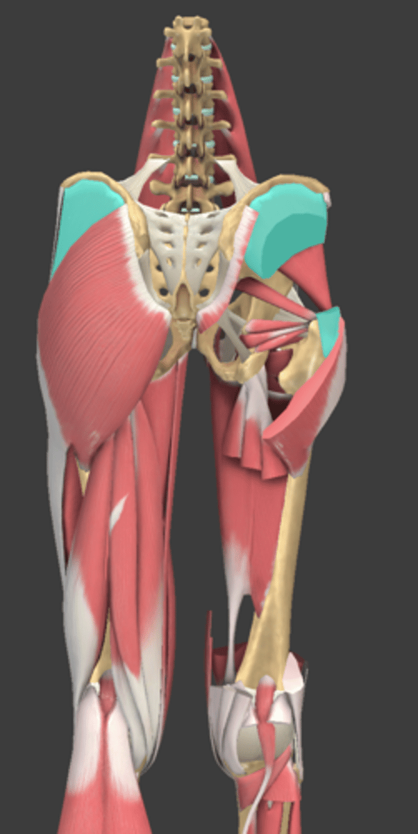 <p>What Muscle Is Highlighted?</p>