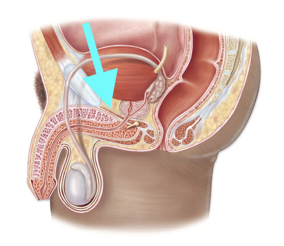 <p>What structure is shown?</p>