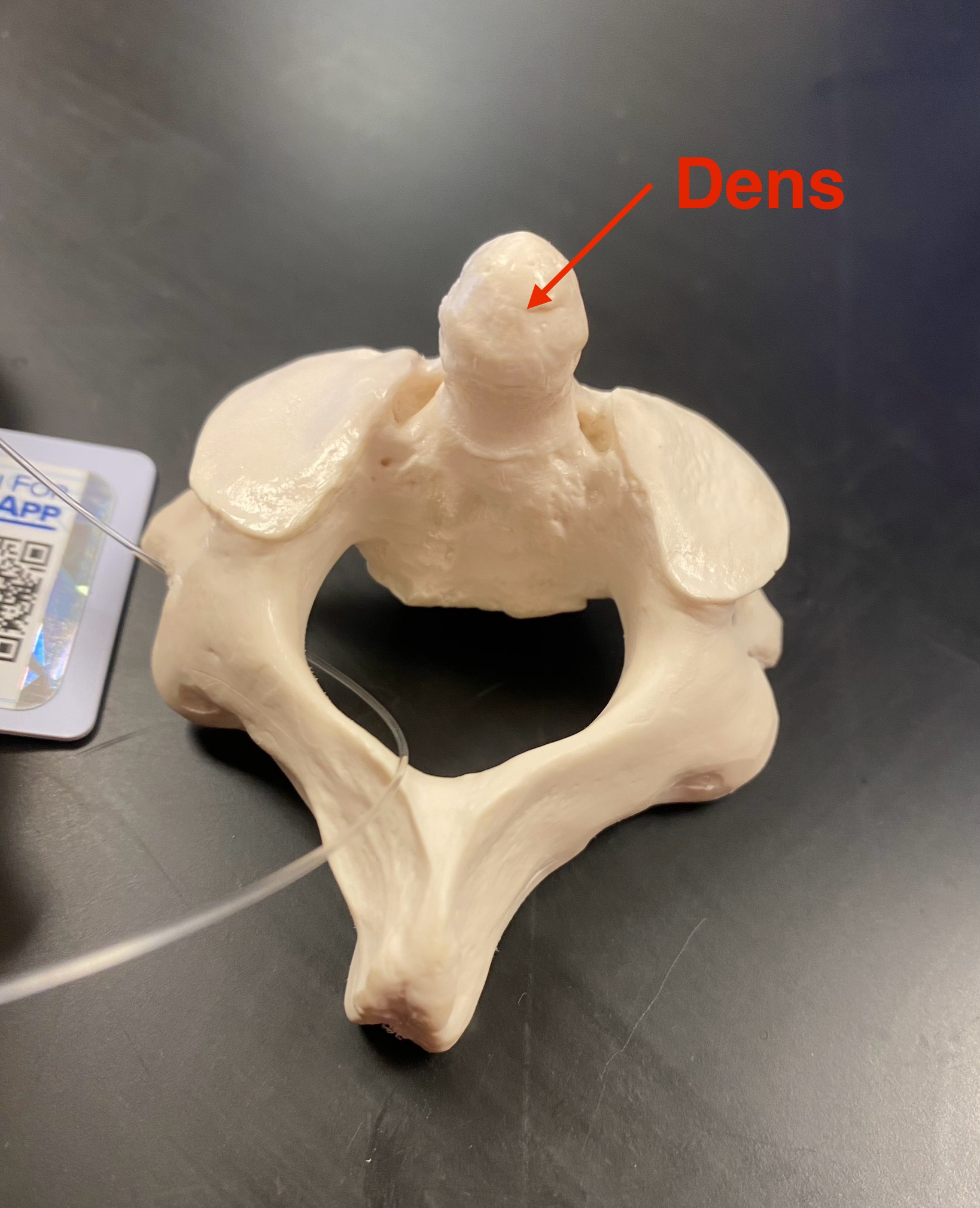 <p><span>allows rotation of the head- has dens</span></p>