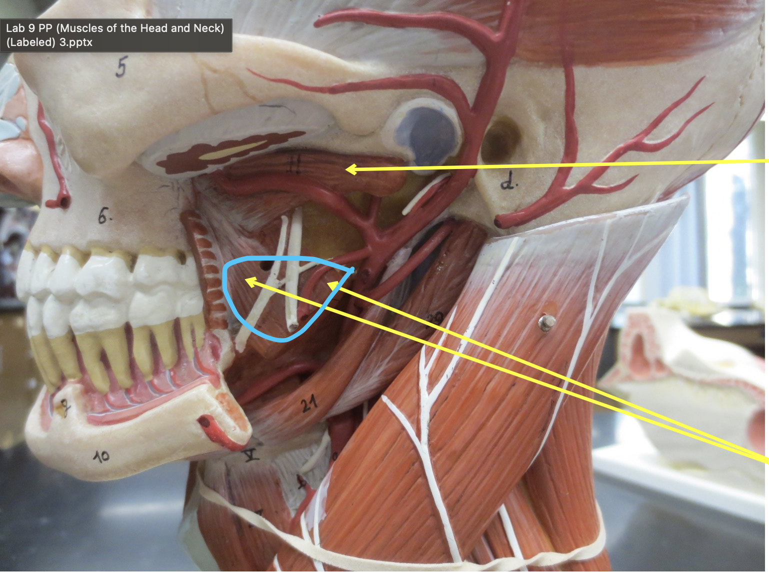 <p>Which muscle</p>