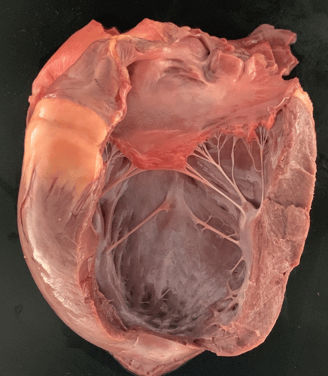 <p>What part of the heart is next for examination?</p>