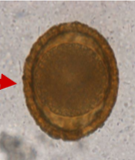 <p>roundworm of the raccoon</p>