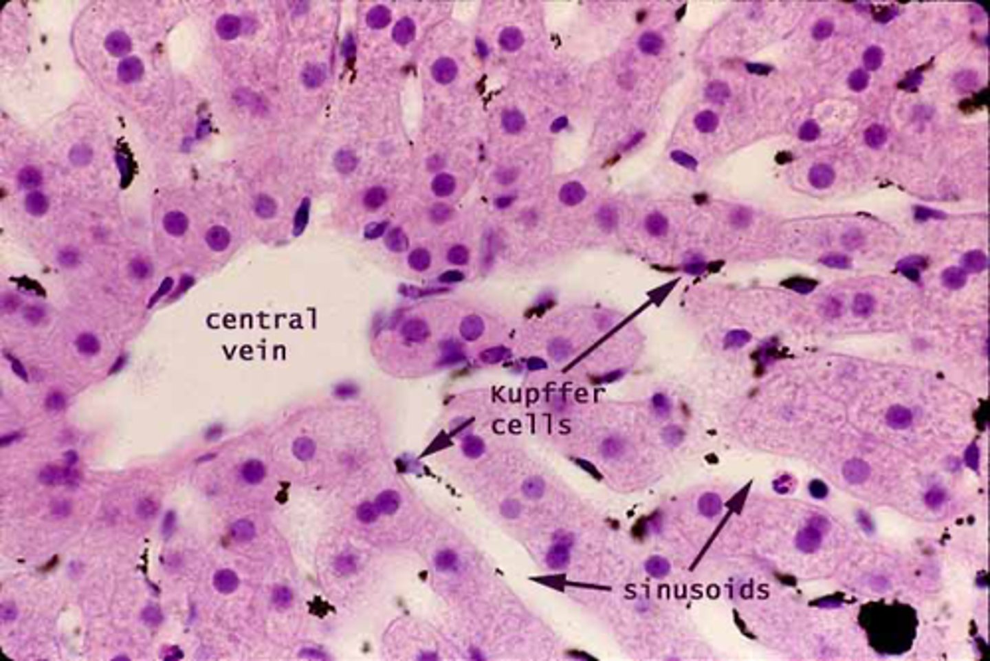 <p>Kupffer cells are specialized macrophages located in the liver that phagocytose unwanted materials, such as bacteria and worn-out blood cells.</p>