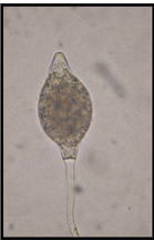 <ul><li><p>Motile asexual oomycete spores</p></li></ul><p>Spore type that can swim in free water because they are equipped with flagella</p>