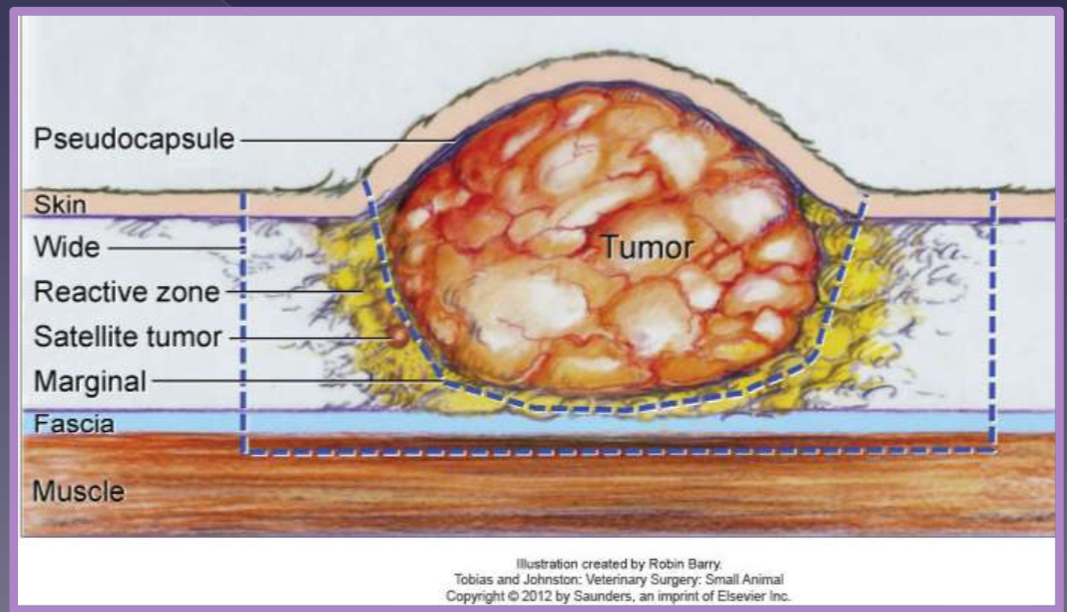 <ul><li><p>Aggressiveness (surgical dose) </p><ul><li><p>intralesional (debulking) </p></li><li><p>marginal </p></li><li><p>wide </p></li><li><p>radical </p></li></ul></li><li><p>dependent on </p><ul><li><p>tumor type </p></li><li><p>tumor grade </p></li><li><p>location of tumor </p></li></ul></li><li><p>intralesional </p><ul><li><p>leave “gross” tumor behind </p></li></ul></li><li><p>marginal </p><ul><li><p>just peripheral to pseudocapsule </p></li><li><p>reactive zone </p></li><li><p>used for benign </p><ul><li><p>lipoma </p></li></ul></li><li><p>satellite tumor </p></li><li><p>common without a prior biopsy </p></li></ul></li><li><p>wide and radical </p><ul><li><p>curative-intent </p></li><li><p>recommended for solid tumors </p></li><li><p>excise a margin of normal tissue </p></li><li><p>deep </p><ul><li><p>1 or 2 facial planes </p></li></ul></li><li><p>radical </p><ul><li><p>entire tissue compartment </p></li><li><p>splenectomy </p></li><li><p>amputation </p></li><li><p>mammary chain </p></li></ul></li></ul></li></ul><p></p>