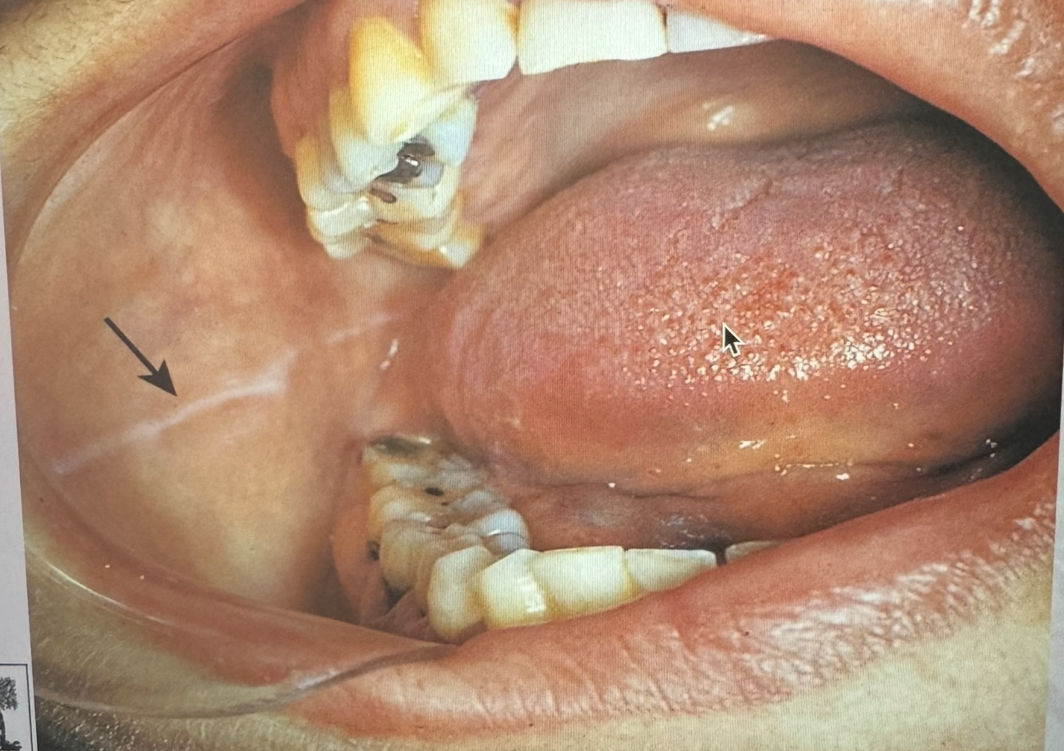 <p>Identify </p>