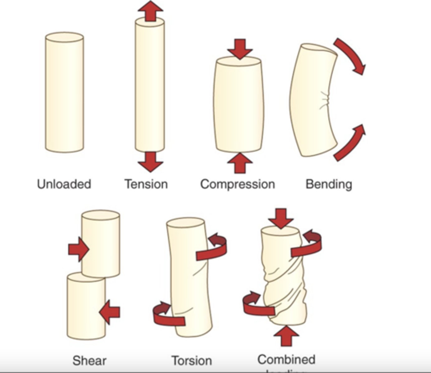 <p>types of musculoskeletal loads</p>