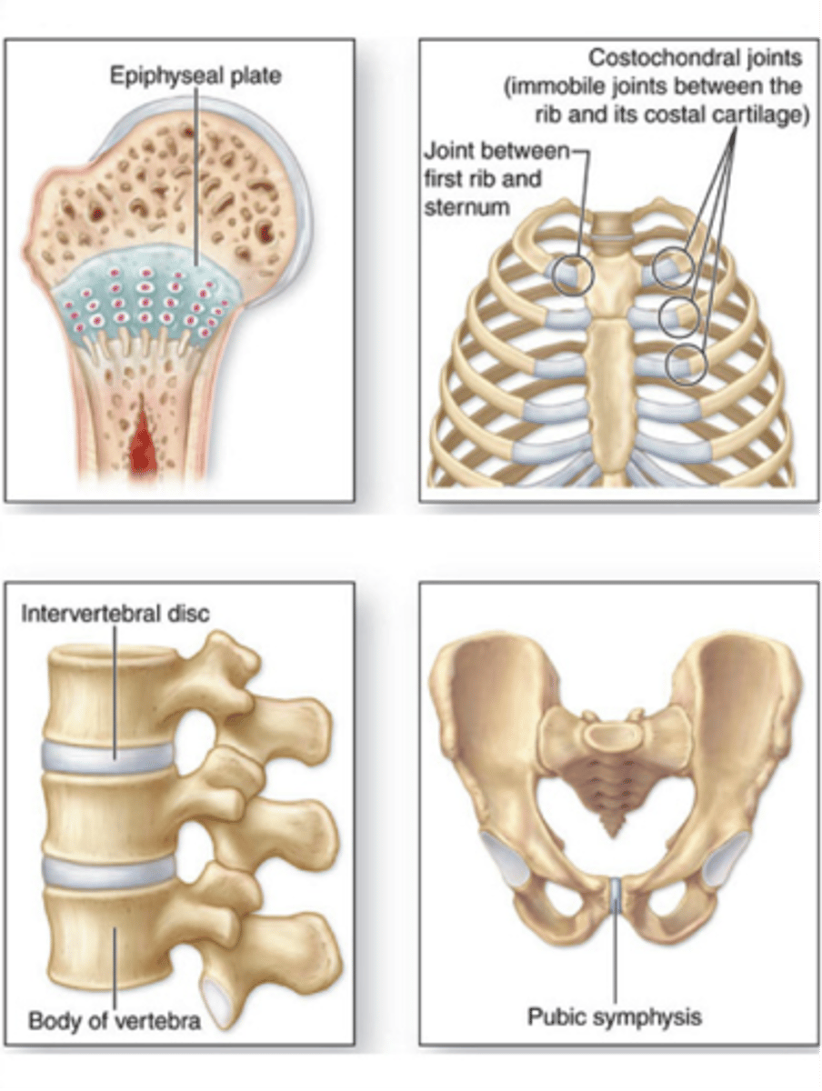 <p>No synovial cavity, cartilage binds articulating bone (fibrocartilage or hyaline), are synarthrosis or amphiarthrosis, ex: synchondroses and symphyses</p>