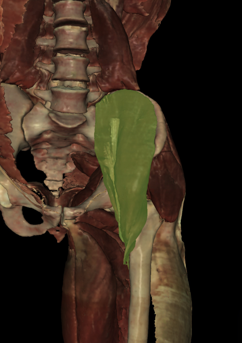 <p>Identify the Structure</p>