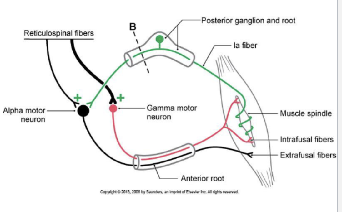 <p><strong><u>***gamma loop</u></strong><u>:</u> <strong><u>activation of gamma motor neurons can indirectly cause activation of an alpha motor neurons thereby mediating muscle contraction</u></strong></p><ul><li><p><strong><u>regulates muscle spindle sensitivity</u></strong> and <strong><u>causes alpha motor neuron to contract protectively</u></strong></p></li><li><p><strong>—&gt; ***<u>when descending control is lost…</u></strong></p><ul><li><p><strong><u>***loss of proper muscle tone</u></strong>, potentially causing <strong><u>hypertonia </u></strong>(increased muscle tone) or <strong><u>hypotonia</u></strong> (decreased muscle tone)</p></li><li><p>***<strong><u>spasticity</u></strong></p></li></ul></li></ul><p><strong><u>***gamma bias </u></strong><em><u>(gain)</u></em><u>:</u> <strong><u>amount of force generated in response to a muscle fiber stretch</u></strong></p><ul><li><p>gain is <strong><u>modulated by descending control (UMN) to meet demands of functional situations</u></strong></p></li><li><p><strong><em>high gain- </em><u>small amount of stretch produces large increase in # of motor units recruited and increased firing rates resulting in large increases in tension</u></strong></p><ul><li><p>e.g. <em>constant postural adjustments on the subway</em>; <em>small postural sway will recruit a large number of motor units</em></p><ul><li><p><em>higher enters will bias the spindles in a way that results in high gain</em></p></li></ul></li></ul></li><li><p><strong><em>low gain- </em><u>greater stretch needed to produce the same level of tension</u></strong></p><ul><li><p>e.g. engaging in <em>yoga</em>; or <em>stretching before a run- when you want to stretch the muscle without activating the stretch reflex at all</em></p><ul><li><p><em>higher enters will bias the spindles in a way that results in low gain</em></p></li></ul></li></ul></li></ul><p></p>