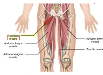 <p>pectineus - adductor</p><p>N</p>