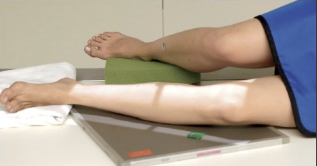 <p>Fine FS, 100cm</p><p>65kVp, 4mAs</p><p>Straight tube</p><p>CR: Midshaft of shin</p>