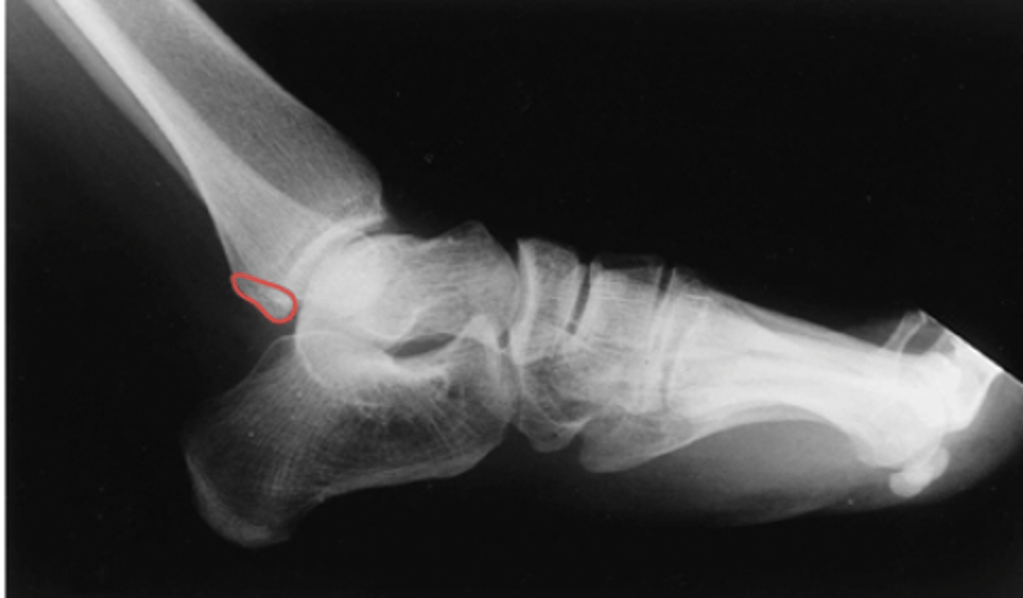 <p>What structure is highlighted?</p>