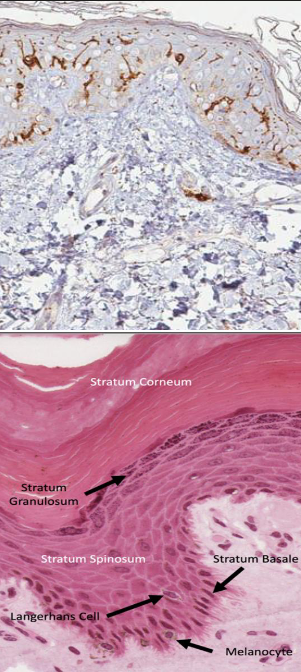 <p>what is developmental origin of langerhans cells? what is its markers?</p>