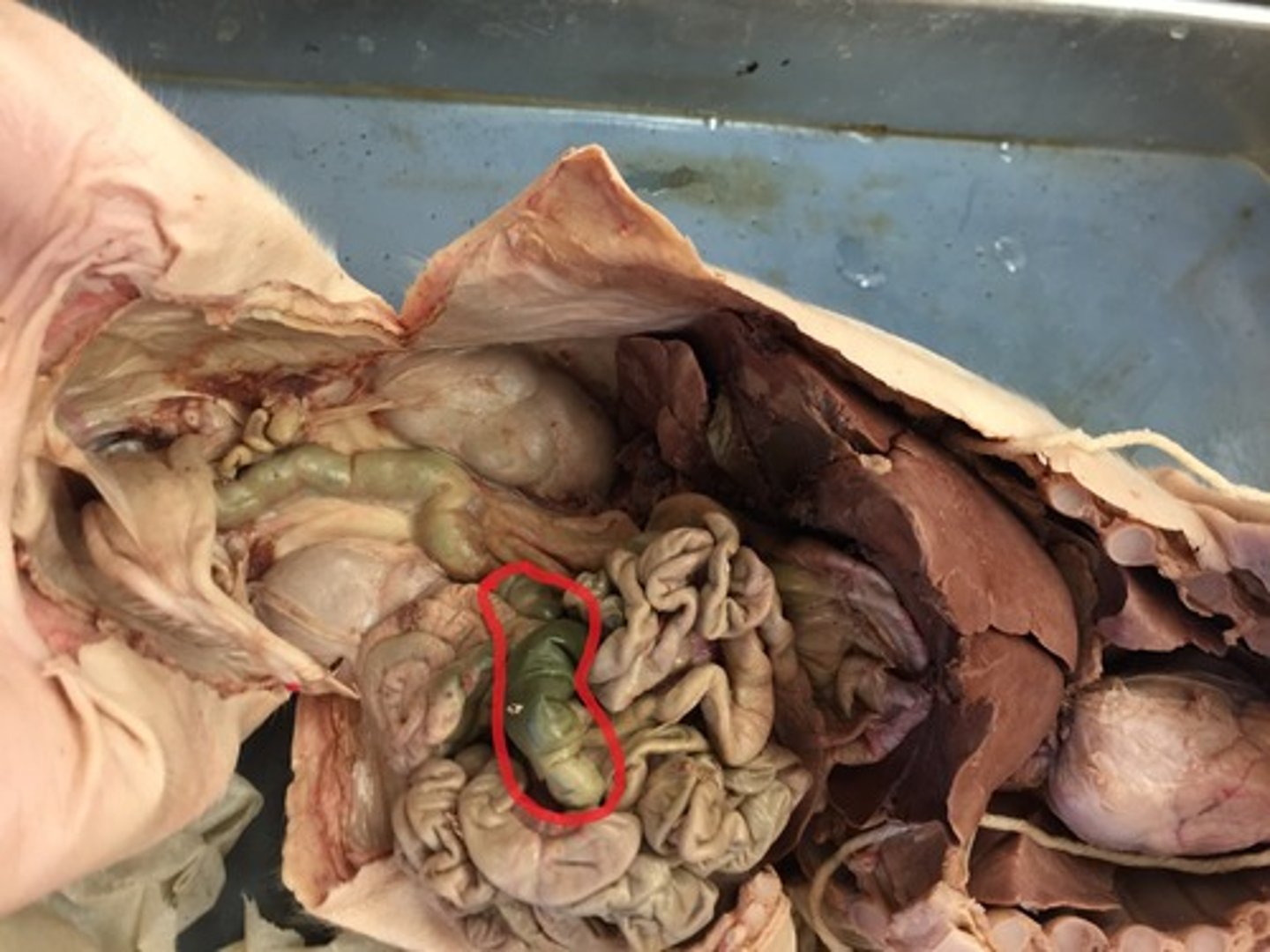 <p>What is the function of the Large Intestine?</p>