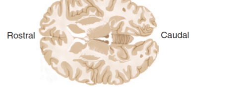 <p>Horizontal/transverse section</p>