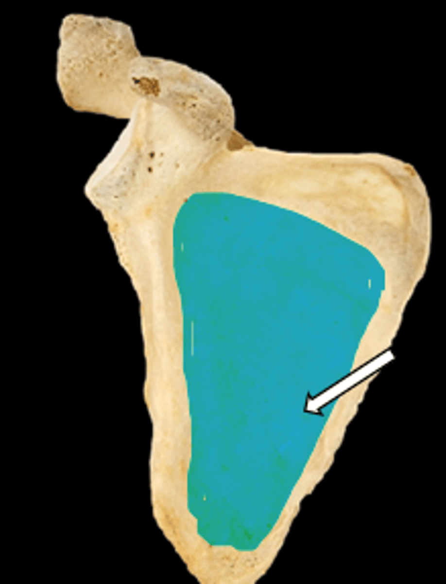 <p>name the part</p>