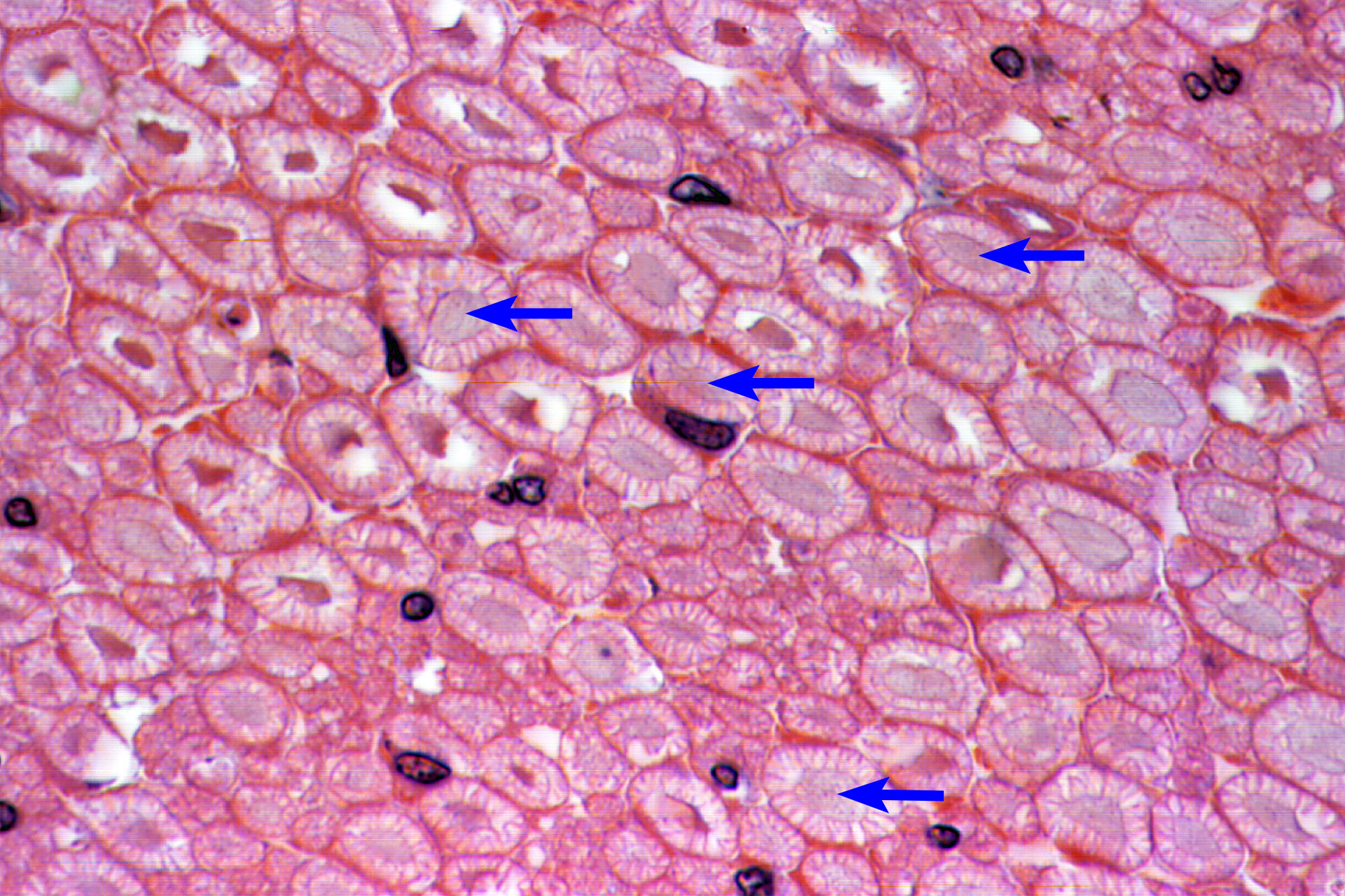 <p>Axons</p>