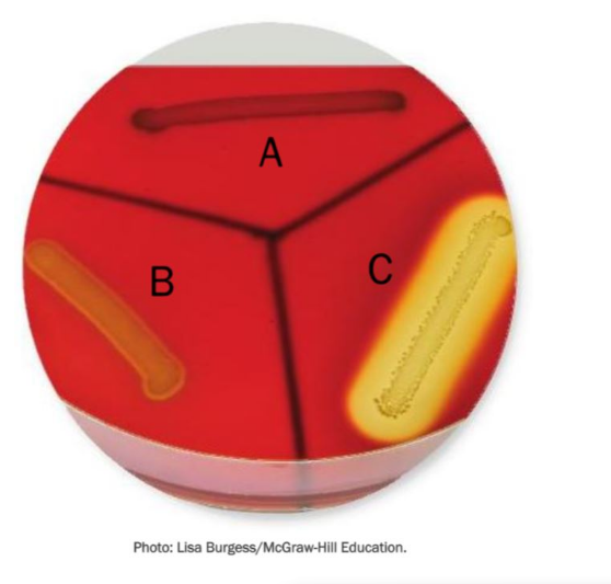 <p><span><span>Which strain of bacteria is producing the most severe hemolysis?</span></span></p>