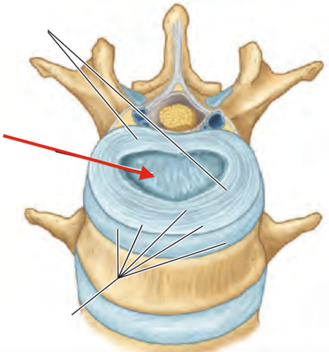 jelly-like center of the intervertebral disc which acts as a "shock absorber"
