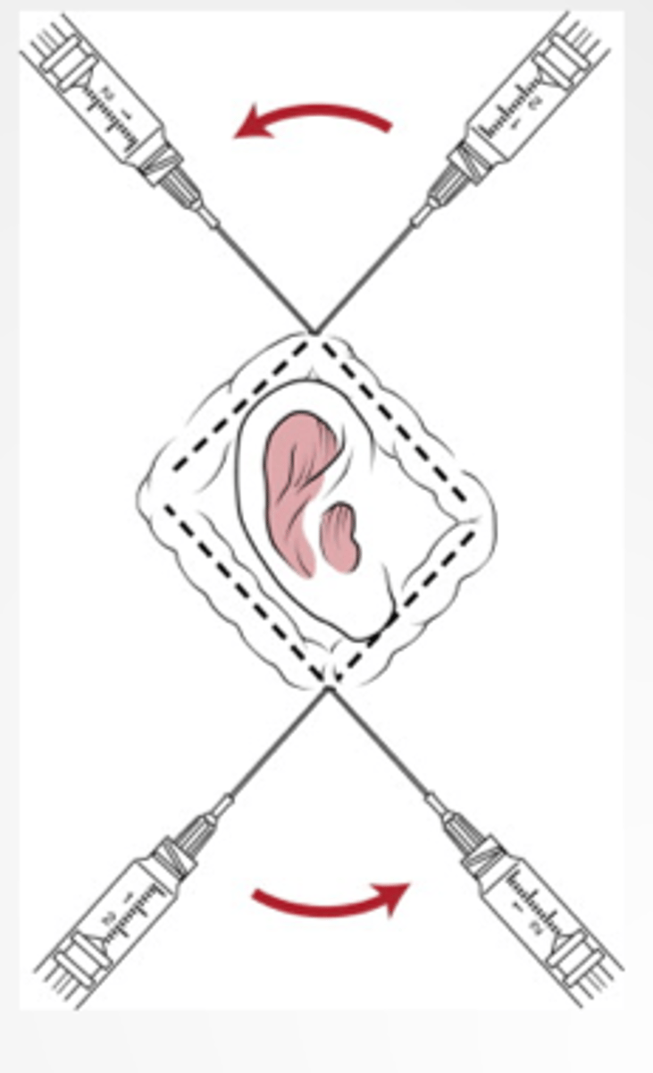 <p>Do not distort</p>