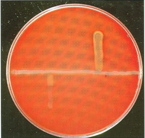 <ol><li><p>Lab Test?</p></li><li><p>Horizontal</p></li><li><p>Left</p></li><li><p>Right</p></li><li><p>Which shows <strong>staphylococcal betahemolysin enhancement</strong>? L or R</p></li></ol><p></p>