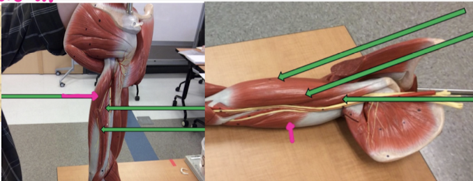 <p>Identify this muscle?</p>