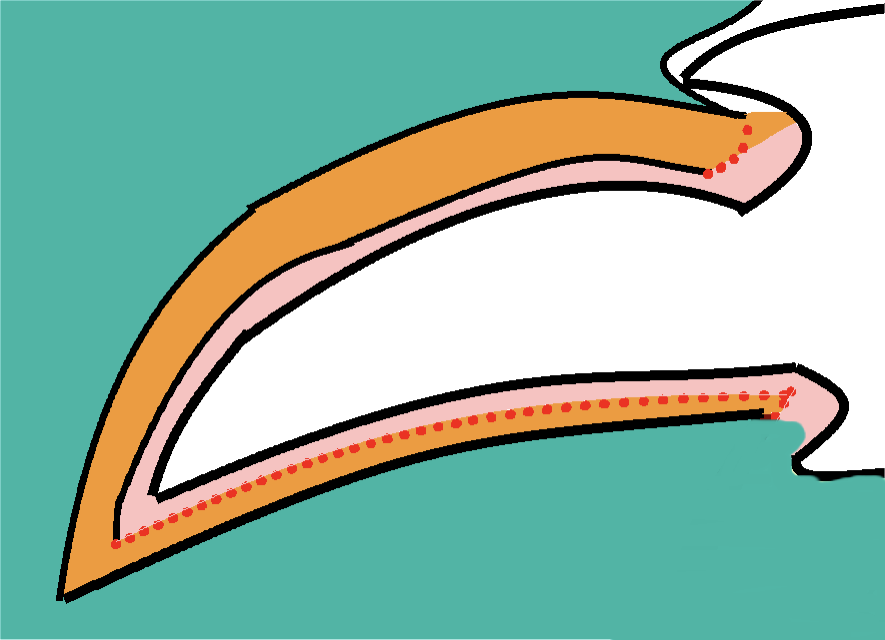 <p><strong>1) Dermis</strong></p><ul><li><p>Fused to the PERIOSTEUM of the<u> ungual process</u></p></li><li><p>Sensitive; bleeds</p></li></ul><p><strong>2) Germinative layer</strong></p><ul><li><p>Active in 2 areas of the claw (red dotted lines on image)</p></li><li><p><u>Recess at ungual crest</u></p><ul><li><p>Forms the dorsal and lateral surfaces of the claw </p></li></ul></li><li><p><u>Palmar surface of ungual process</u></p><ul><li><p>Forms the UNDERSIDE of claw</p></li></ul></li><li><p>This is how the claw grows </p></li></ul><p><strong>3) Epidermis </strong></p><ul><li><p>Heavily keratinized (horn ± pigment)</p></li></ul><p></p>