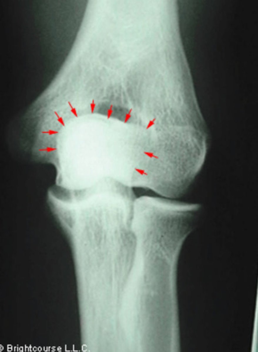 <p>What structure is being pointed out by the arrows?</p>