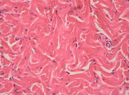 <p>Dense Connective Tissue, Irregular Type</p>