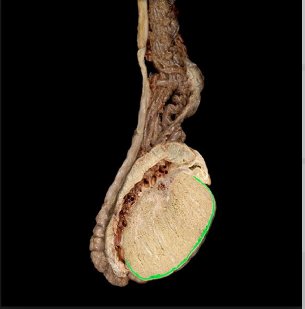 <p>what is this outer sac covering the testis?</p>